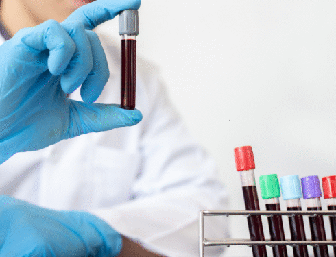 Veterinarian wearing blue gloves holding a blood sample tube for a dog allergy test in a lab.